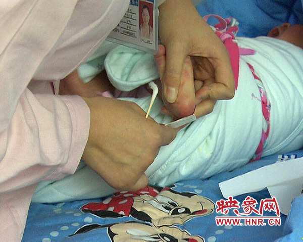 醫(yī)護(hù)人員在為一名新出生嬰兒采足跟血，做疾病篩查