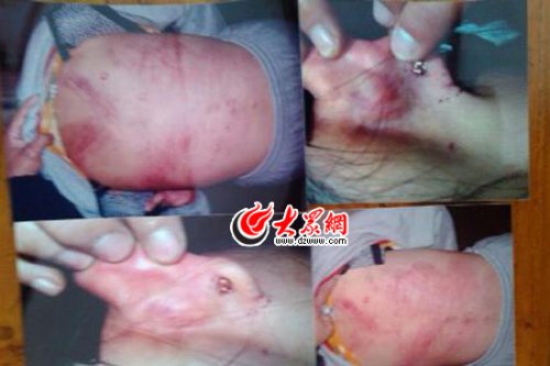 　山東藝術(shù)設(shè)計(jì)學(xué)院16歲女生宿舍內(nèi)被女同學(xué)暴打4小時(shí)。