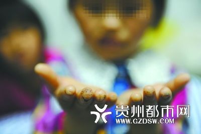 指尖被針扎得傷痕累累。
