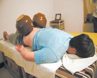 拔泡菜壇子火罐。