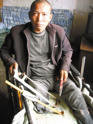 鄭艷良就是用這幾樣簡(jiǎn)陋工具，給自己做了右腿截肢手術(shù)。