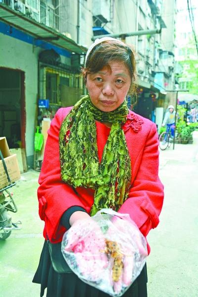 頭部受傷的黃女士展示兩根大魚刺。