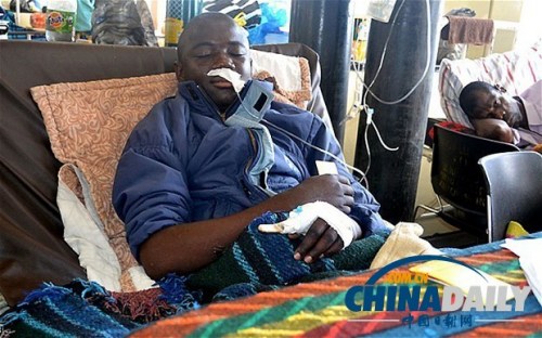雖然已經(jīng)在醫(yī)院接受了近一個月的恢復(fù)治療，卡托卡的身體仍然非常虛弱。