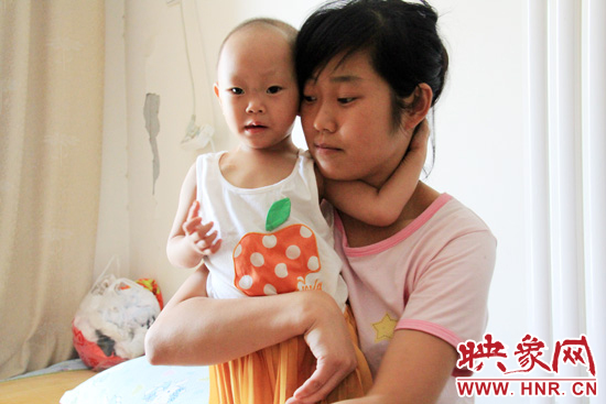 孩子和媽媽在一起，她的右眼已經(jīng)失明。