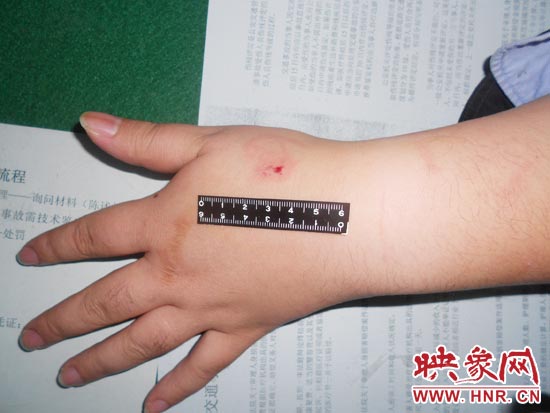為幫助無證駕駛的朋友逃避處罰，新鄉(xiāng)的王某竟對執(zhí)勤民警大打出手，還將一名民警的手臂咬傷