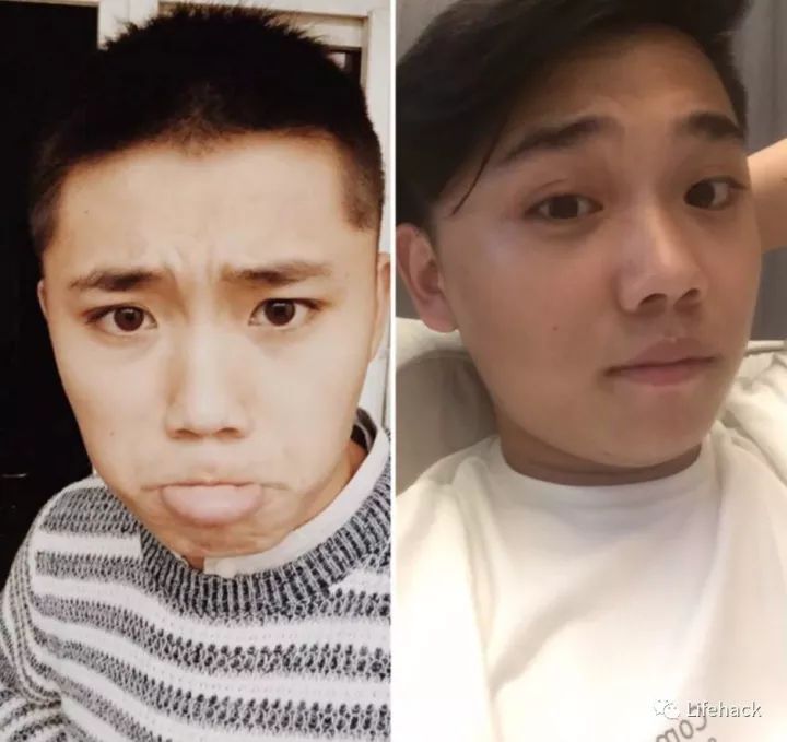 長胖20斤，臉型怎么變？這些例子看完扎心了！