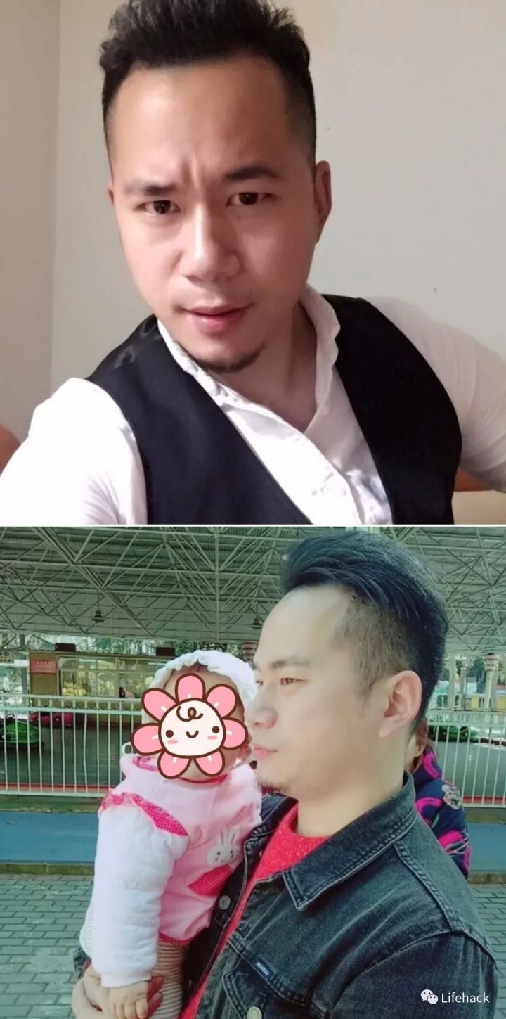 長胖20斤，臉型怎么變？這些例子看完扎心了！
