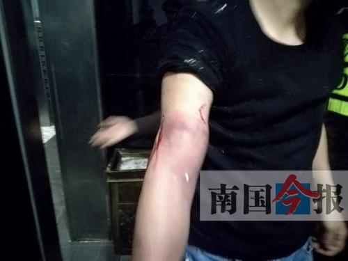 覃先生手臂被卡的部位受傷流血，所幸傷勢無大礙。 通訊員 王建民 攝