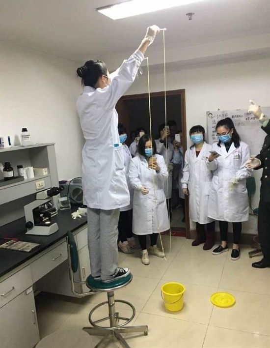 愛吃生肉惹的禍！男子體內(nèi)取出5米長寄生蟲(圖)