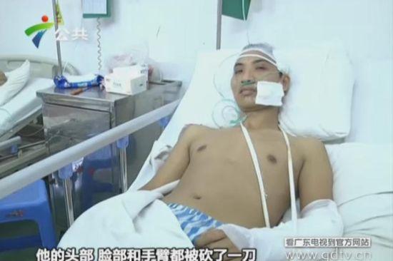 另一名傷者頭部、臉部和手臂都被砍了一刀。(視頻截圖)