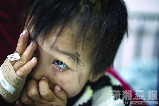 1月13日，湖南省兒童醫(yī)院，4歲的源源用手蒙住了眼睛。