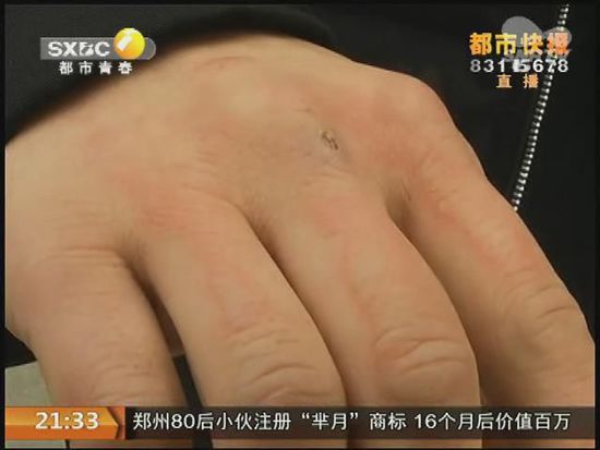 說到這足療拔罐，估計大伙都不陌生，但是想起4號晚上的拔罐的經(jīng)歷，呂先生現(xiàn)在想起來，還心有余悸。