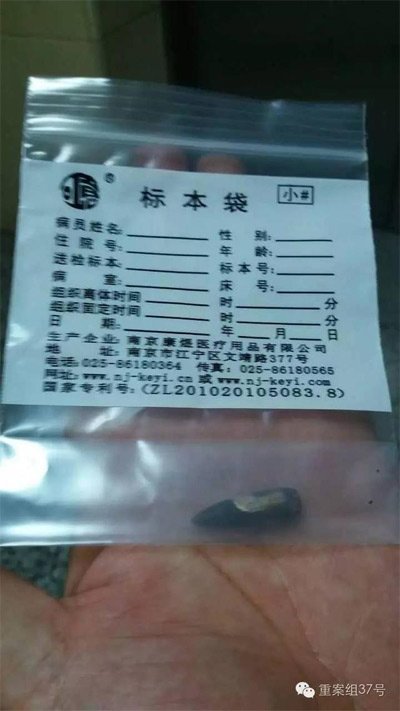 經(jīng)警方鑒定，秦女士體內(nèi)取出的子彈系56式步槍射出 。 受訪者供圖